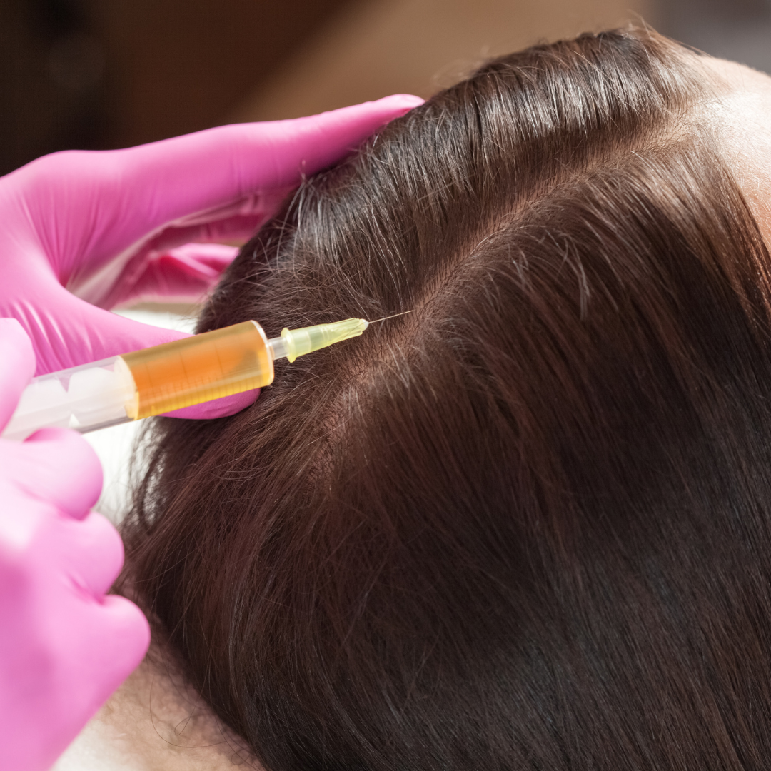 Hair Loss